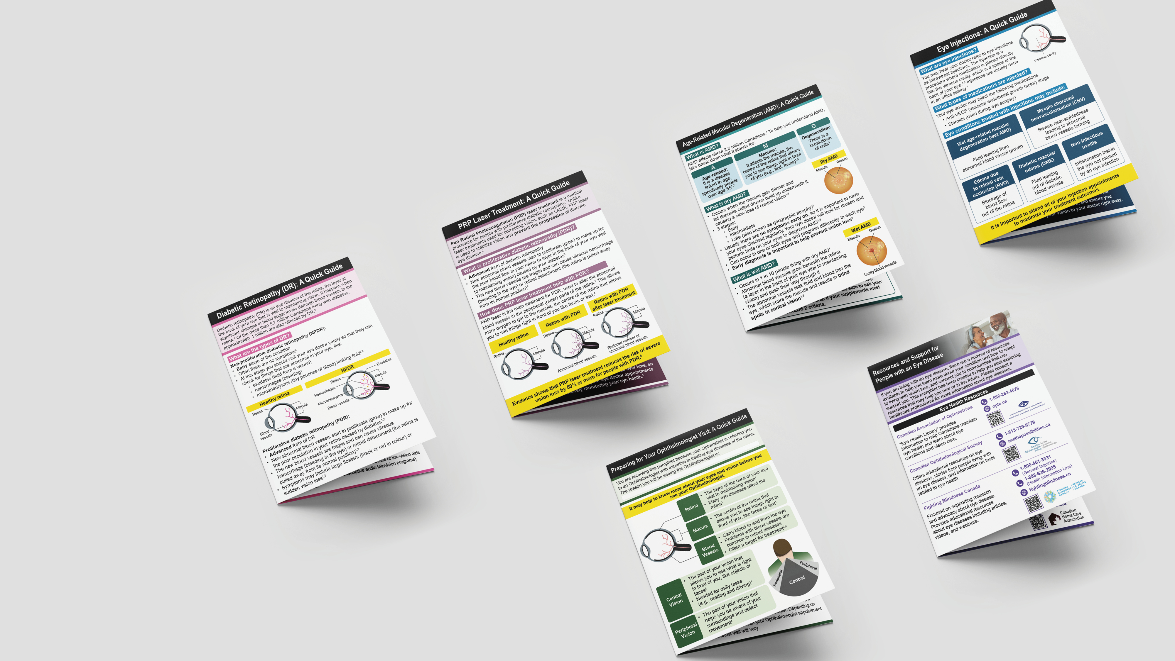 Five ophthalmology quick guides spread for different interventions or eye diseases.