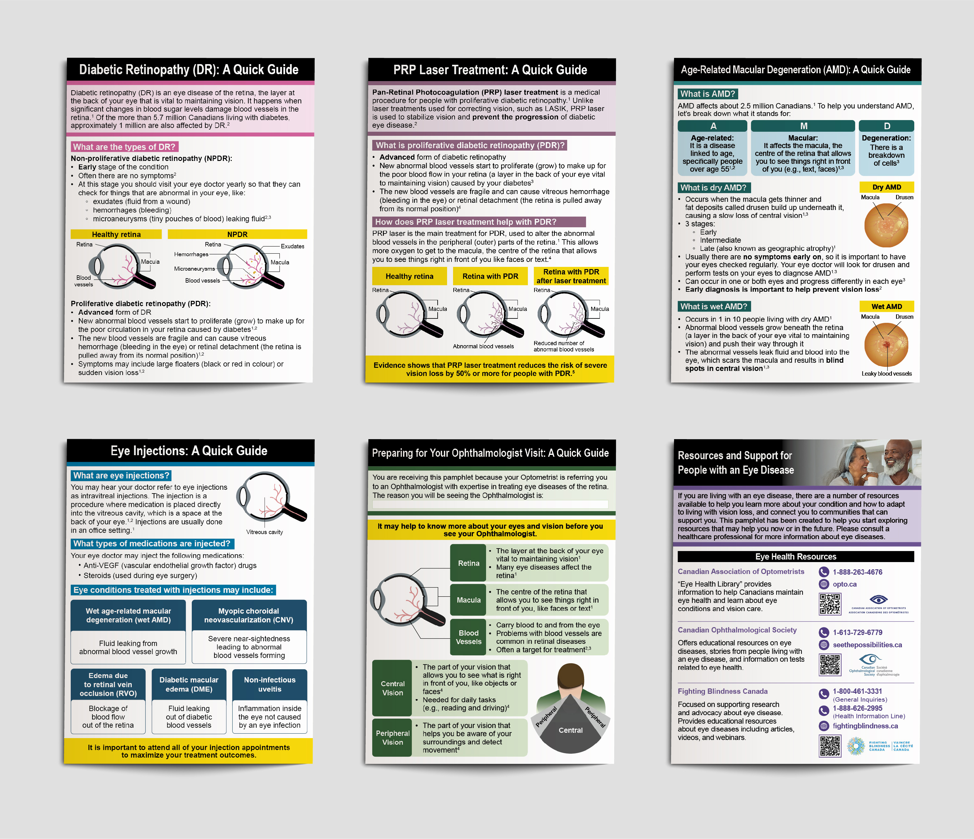 Six ophthalmology quick guides spread for different interventions or eye diseases.